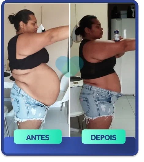 Antes e depois de cliente usando Ozenvitta