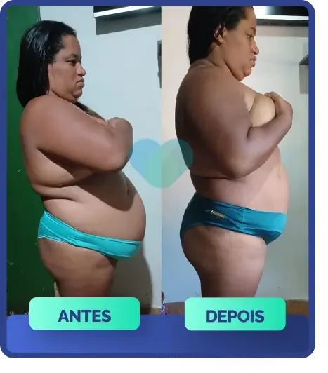 Antes e depois de cliente usando Ozenvitta